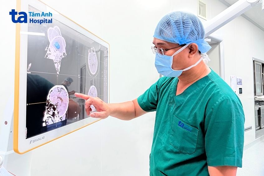 Bác sĩ đang xem xét hình ảnh 3D sọ não trên hệ thống Brainlab, xác định vị trí khối máu tụ và túi phình, lên kế hoạch phẫu thuật.