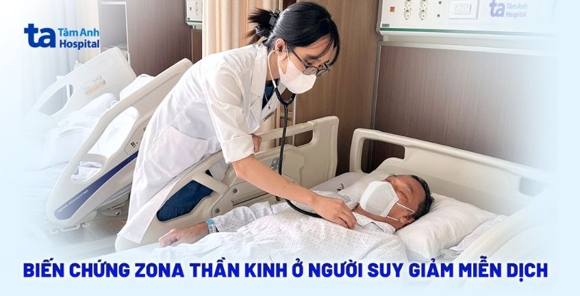 Liệt mặt, viêm màng não do biến chứng zona thần kinh