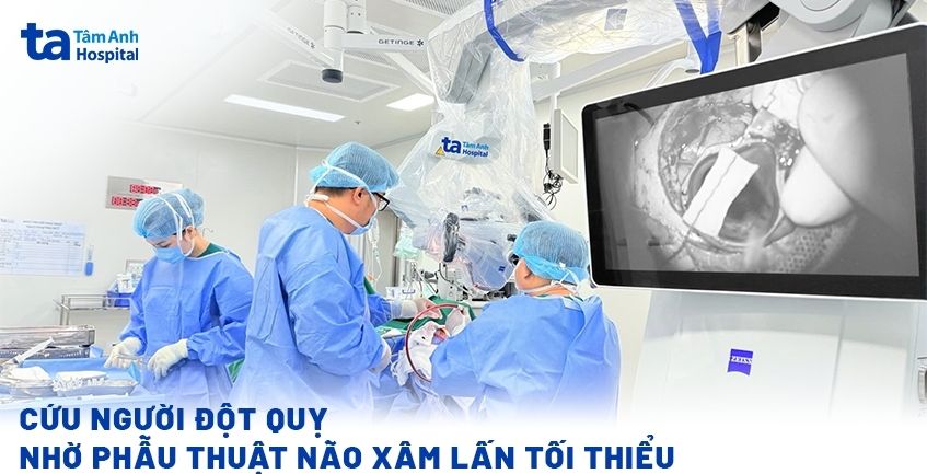 Cứu người đột quỵ nhờ phẫu thuật não xâm lấn tối thiểu