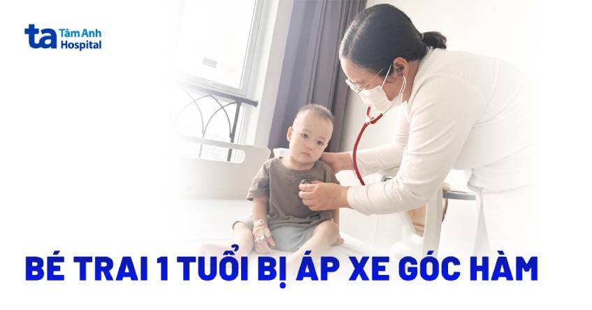 Bé trai 1 tuổi áp xe góc hàm