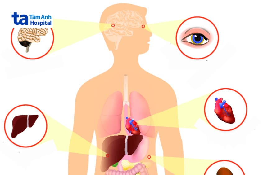 bệnh gây rối loạn chuyển hóa và tích tụ đồng