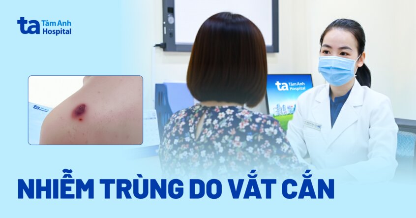 Bị nhiễm trùng do vắt cắn