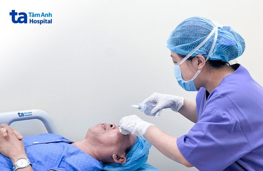 bệnh nhân được bác sĩ nhỏ thuốc rửa mắt