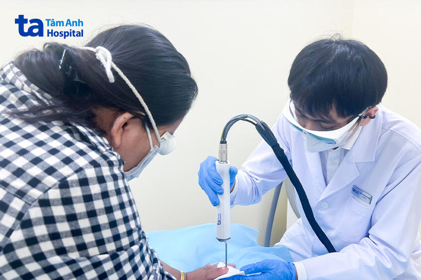 bệnh nhân được điều trị bằng laser yag