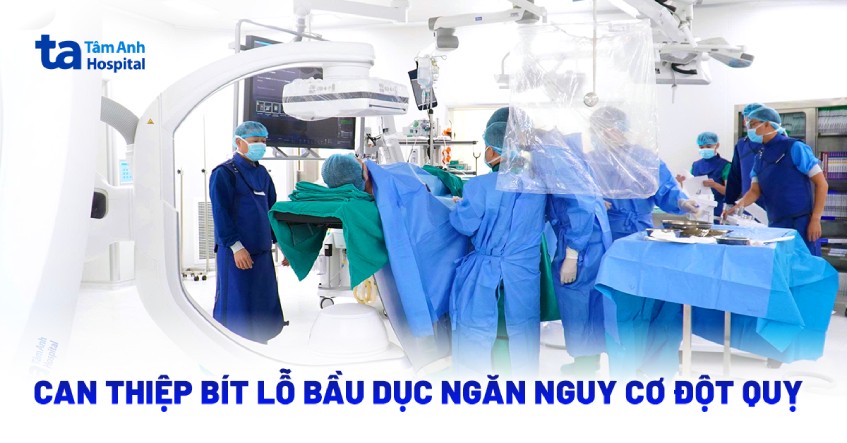 Bít lỗ bầu dục ngăn nguy cơ đột quỵ