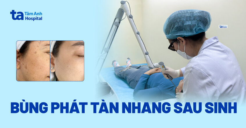 bùng phát tàn nhang sau sinh