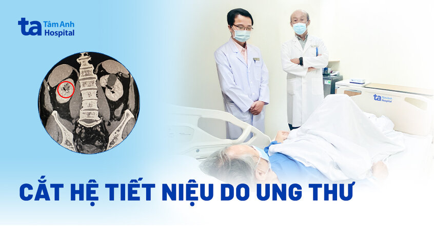 Cắt hệ tiết niệu do ung thư