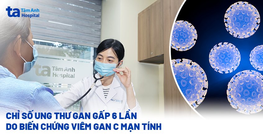Chỉ số ung thư gan gấp 6 lần do biến chứng viêm gan C mạn tính