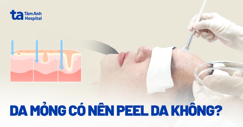 Da mỏng yếu có nên peel da không?