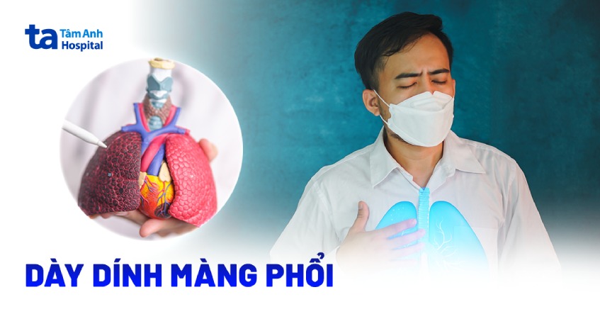 Dày dính màng phổi có nguy hiểm không? Triệu chứng và cách xử lý
