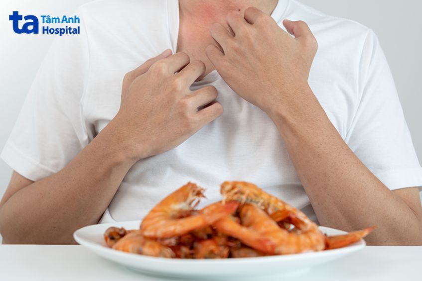 Dị ứng hải sản do phản ứng miễn dịch với protein