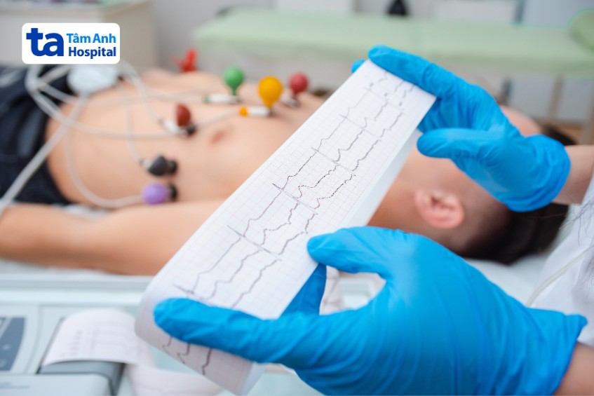 Điện tâm đồ (ECG) chẩn đoán được tình trạng tăng huyết áp độ 1