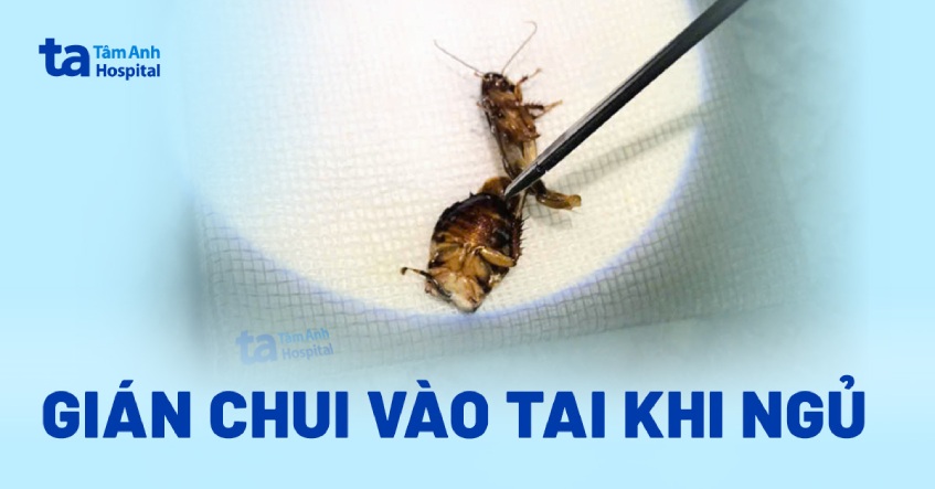 Gián chui vào tai khi ngủ