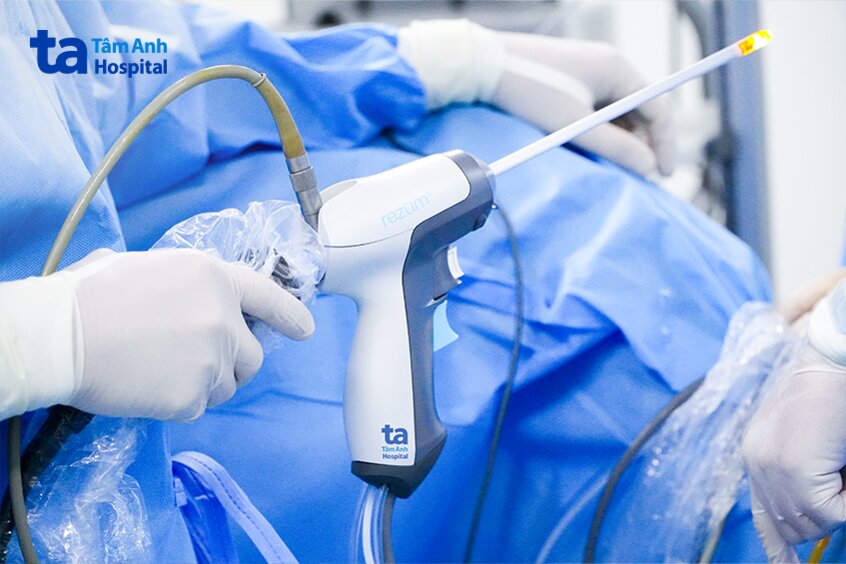 hình ảnh liệu pháp hơi nước rezum trong điều trị