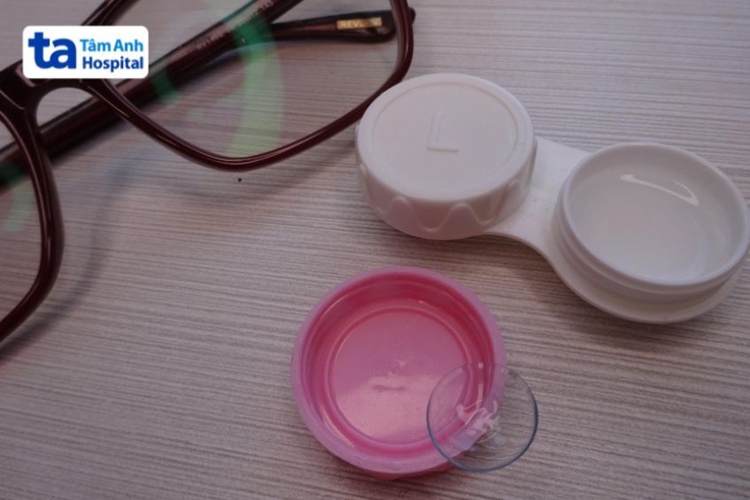 Loạn Thị Đeo Kính Gì? Cách Chọn Kính Loạn Thị Phù Hợp Kính Áp Tròng Mềm Cải Thiện Thị Lực, Giữ Thẩm Mỹ Khi Vận Động