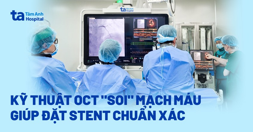 Kỹ thuật hiện đại phát hiện chính xác nguyên nhân nhồi máu cơ tim
