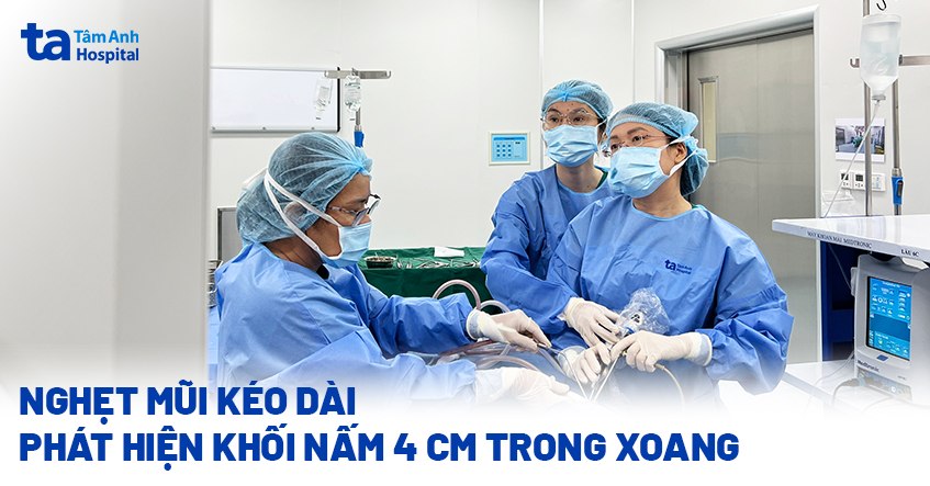 Nghẹt mũi kéo dài, phát hiện khối nấm 4 cm trong xoang