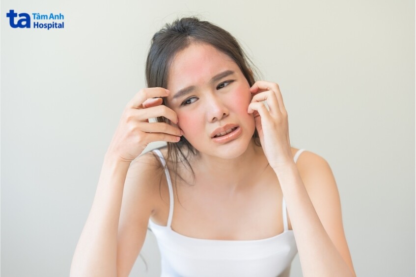 Peel Da Bị Ngứa Phải Làm Sao? Ngứa Kéo Dài Sau Peel Bao Lâu Là Nguy Hiểm