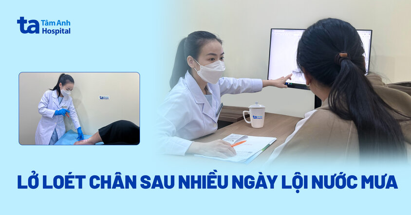 Nhiễm nấm da sau nhiều ngày lội nước mưa