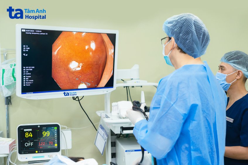nội soi phát hiện ung thư dạ dày sớm