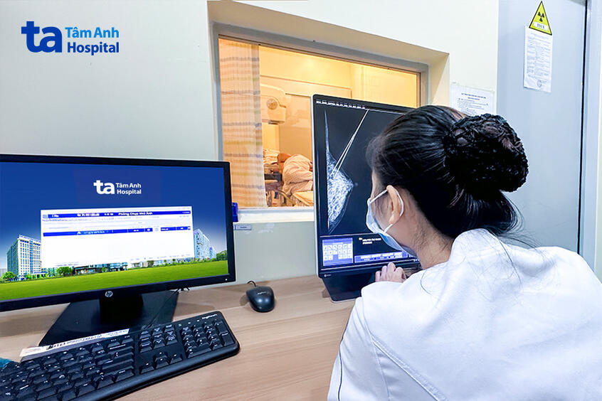 nhân viên y tế lấy mẫu sinh thiết