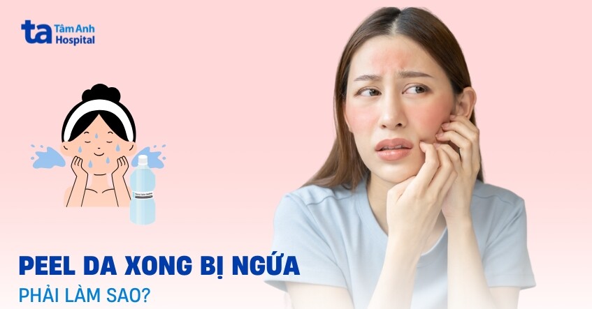 Peel da bị ngứa phải làm sao?