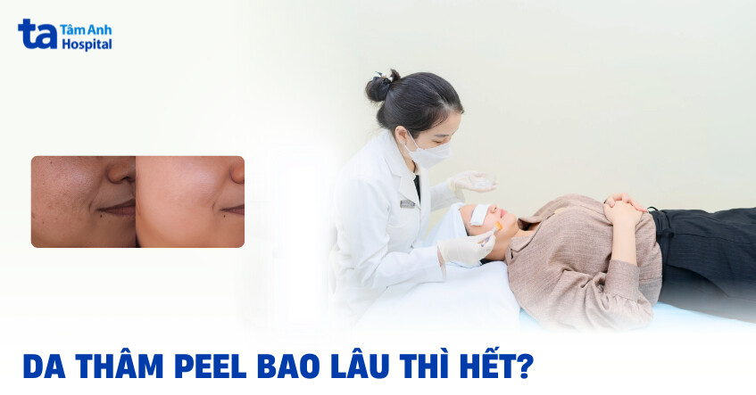 Giải đáp nhanh: Peel da trị thâm có hiệu quả không?
