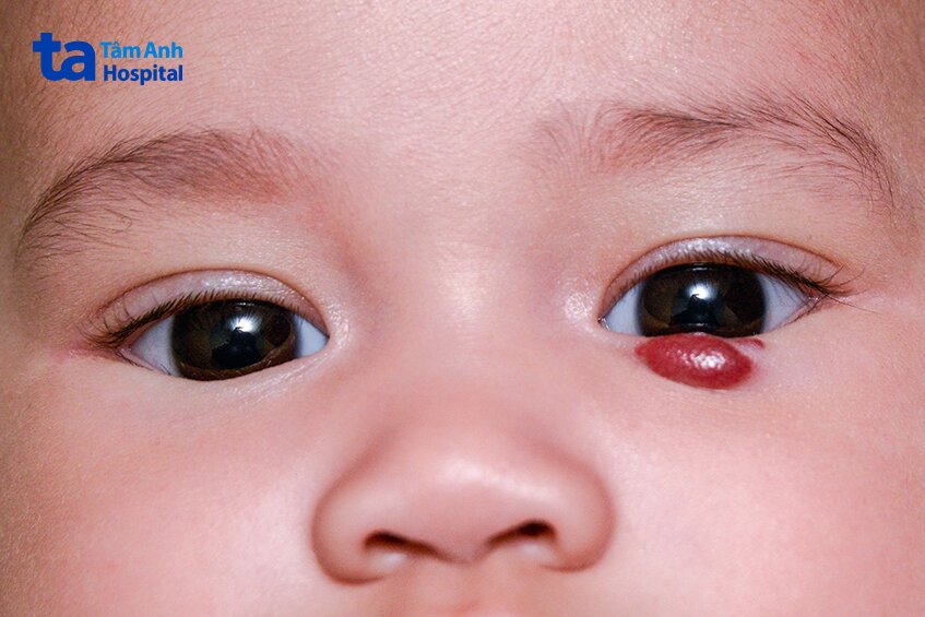 phương pháp an toàn cho trẻ nhỏ