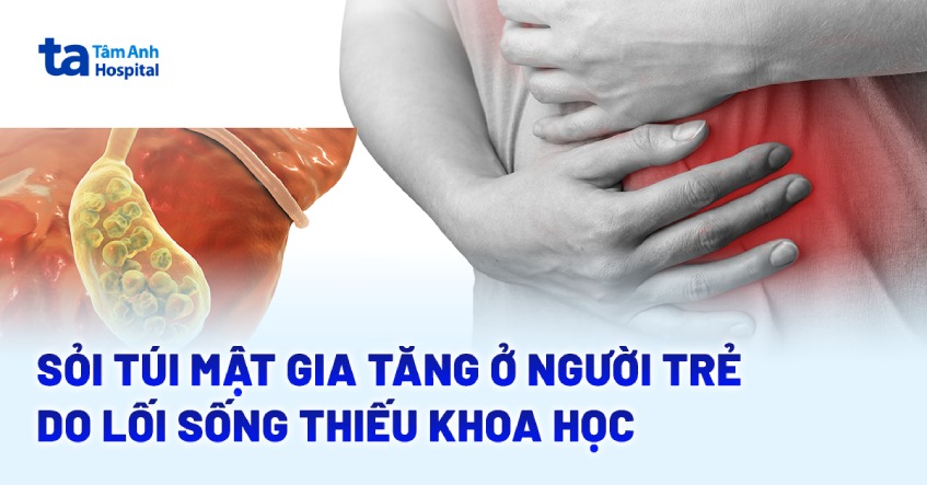 Sỏi túi mật gia tăng ở người trẻ do lối sống thiếu khoa học