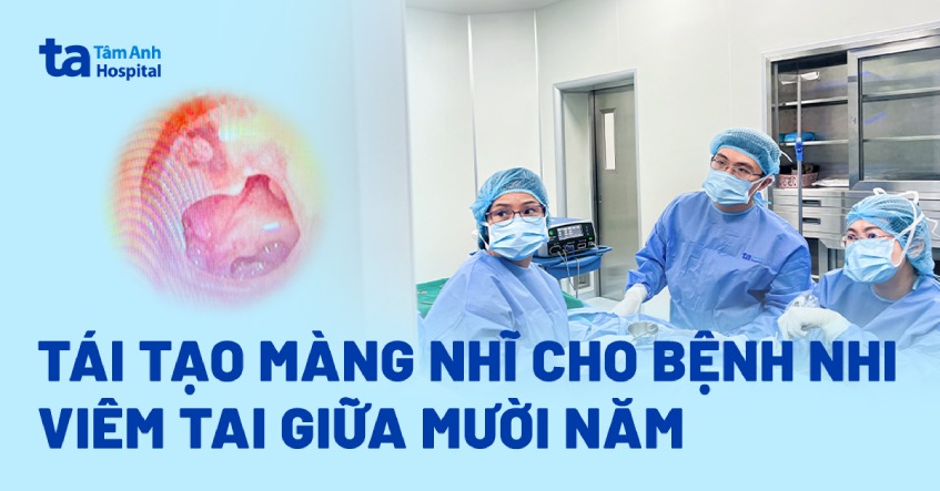 Tái tạo màng nhĩ cho bệnh nhi viêm tai giữa mười năm