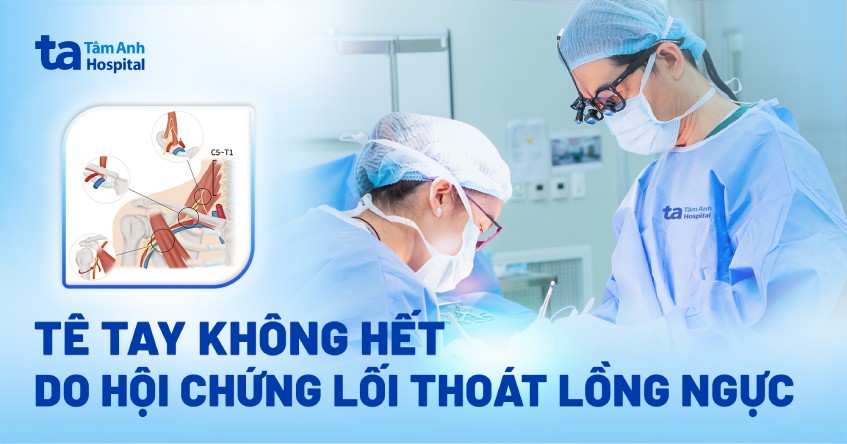 Tê tay tưởng bệnh cột sống hóa hội chứng ít gặp