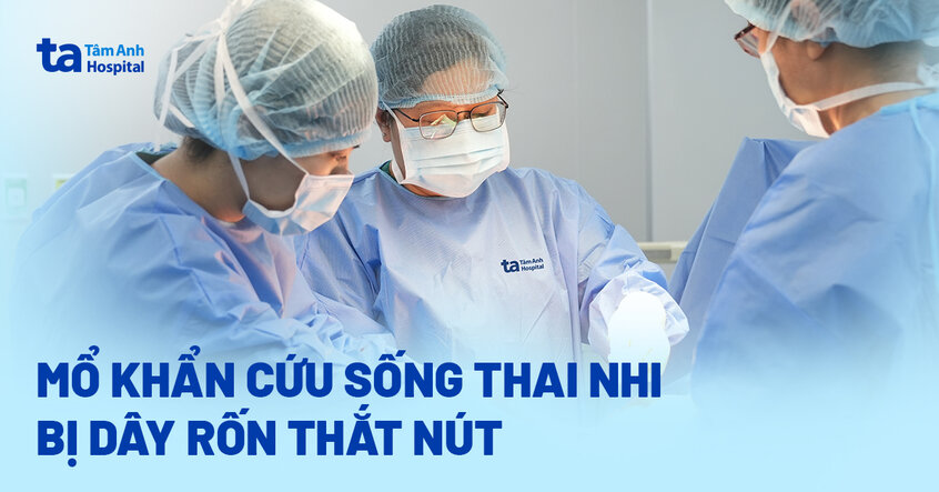 Mổ khẩn cứu sống thai nhi bị dây rốn thắt nút