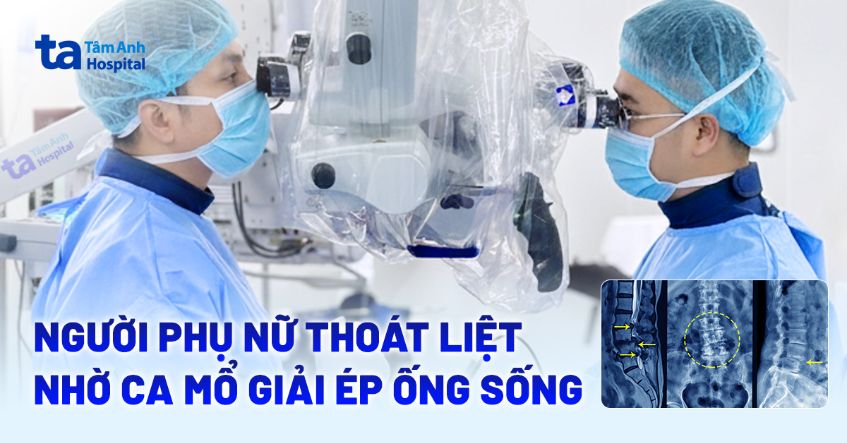 Người phụ nữ thoát liệt nhờ ca mổ giải ép ống sống