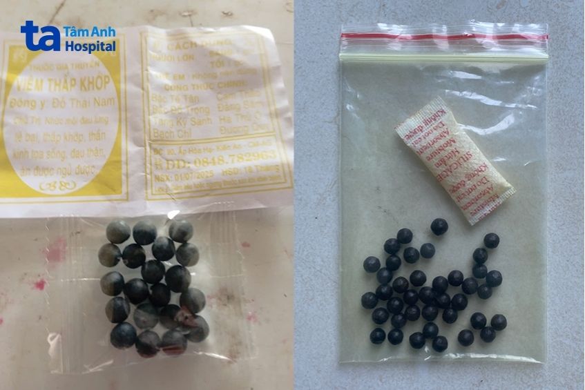 thuốc gia truyền bệnh nhân tự mua