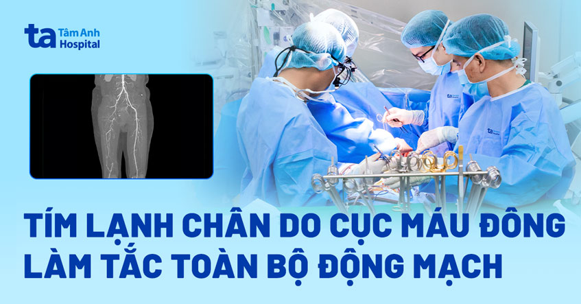 Tím lạnh chân do cục máu đông làm tắc toàn bộ động mạch