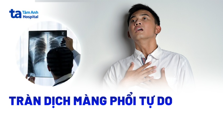 Như thế nào là tràn dịch màng phổi tự do?