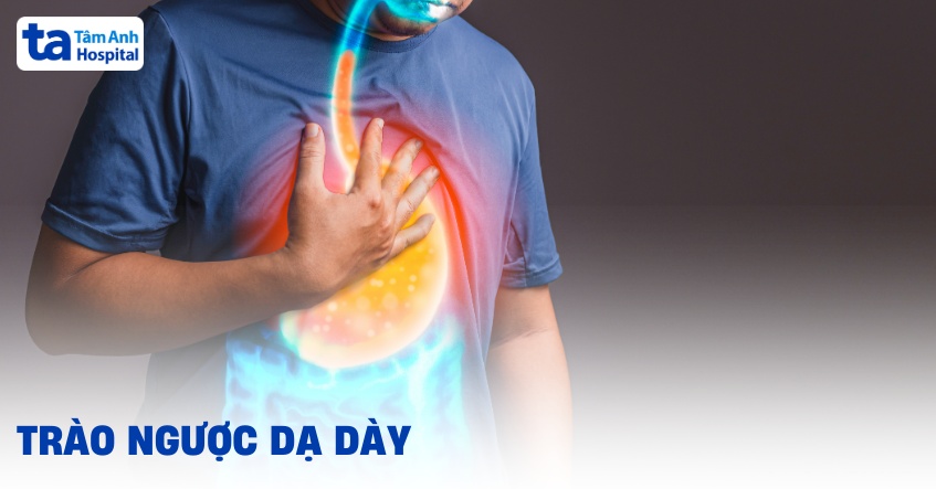 Trào ngược dạ dày: Nguyên nhân, dấu hiệu và phòng ngừa