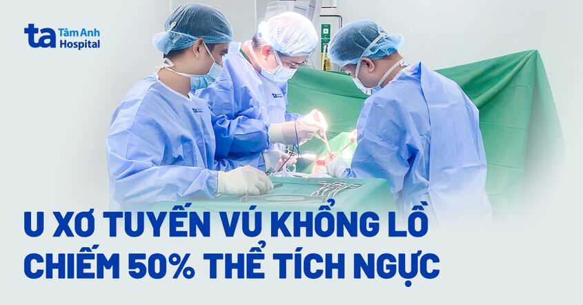 U xơ tuyến vú khổng lồ chiếm 50% thể tích ngực