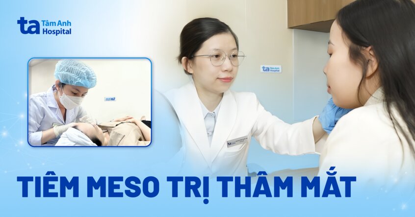 xóa quầng thâm mắt sau tiêm meso