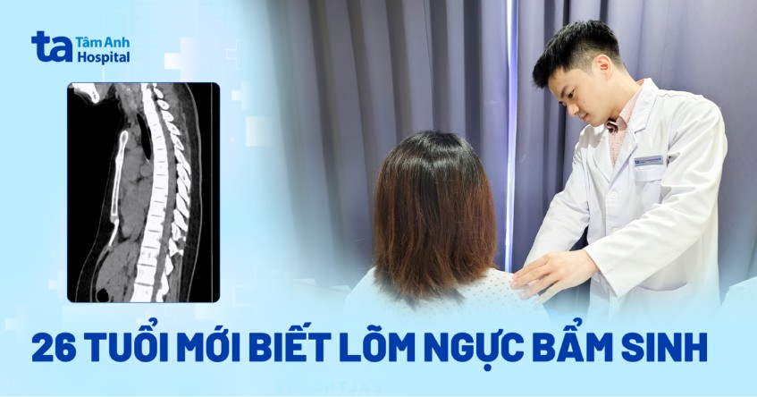 26 tuổi mới biết lõm ngực bẩm sinh