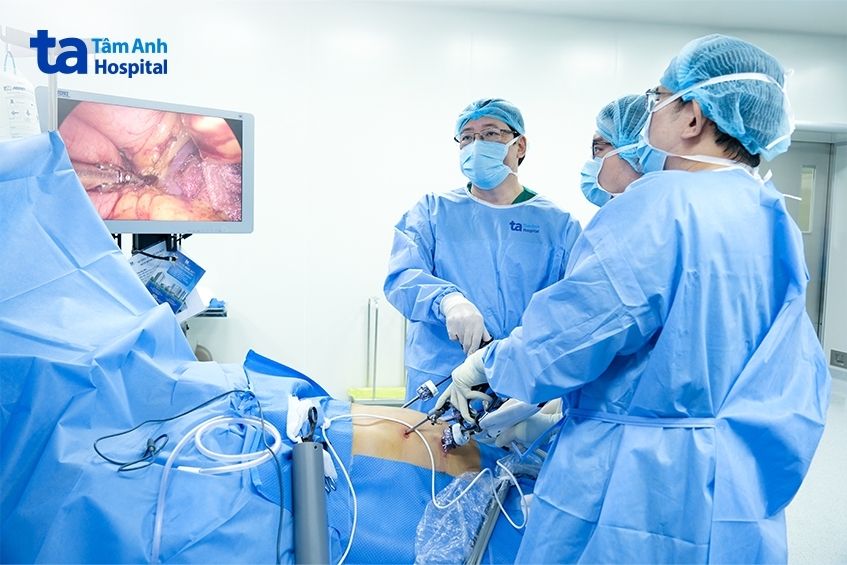 Các bác sĩ đang phẫu thuật bóc tách khối u ác tính ở thực quản cho người bệnh.