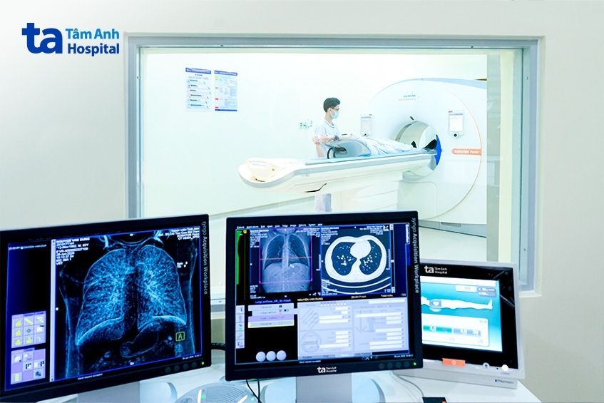 Chụp CT Scan tầm soát ở Bệnh viện Đa khoa Tâm Anh TP.HCM (cơ sở P.Tân Hưng - Q.7 cũ).