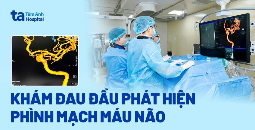 Khám đau đầu phát hiện phình mạch máu não