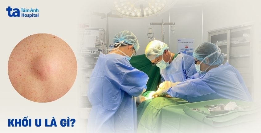 Khối u là gì? Nguyên nhân hình thành và cách nhận biết