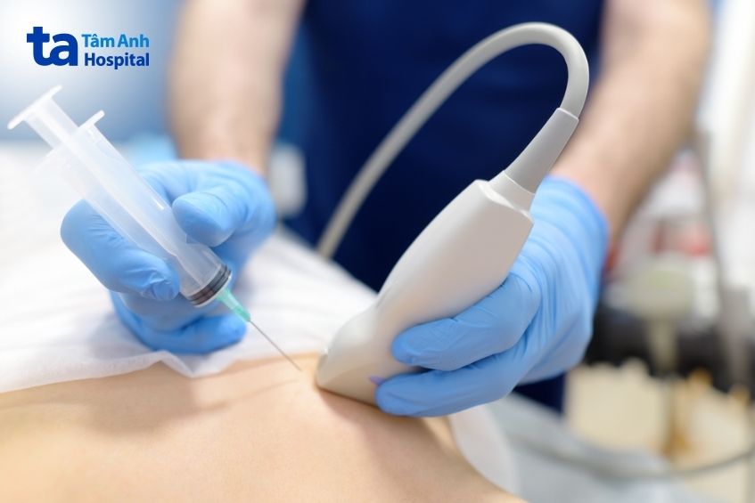 Sinh thiết để phân tích mẫu mô là phương pháp dùng để tìm kiếm sự hiện diện của tế bào ung thư.