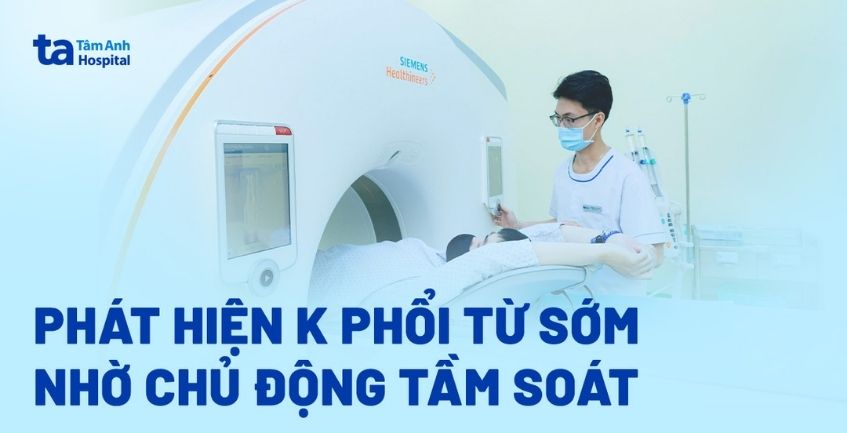 Tìm dấu tích ung thư phổi giai đoạn sớm