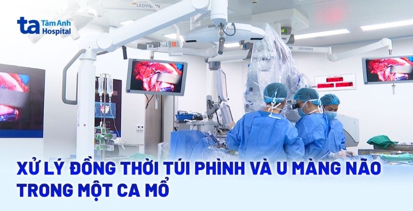 Xử lý đồng thời túi phình và u màng não trong một ca mổ