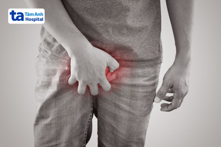 Áp xe tinh hoàn là tình trạng nhiễm trùng nghiêm trọng cần được chẩn đoán và điều trị sớm