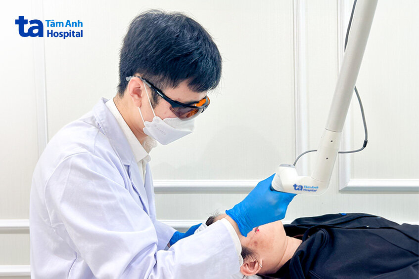 bác sĩ sử dụng laser pico phá vỡ các sắc tố dưới da