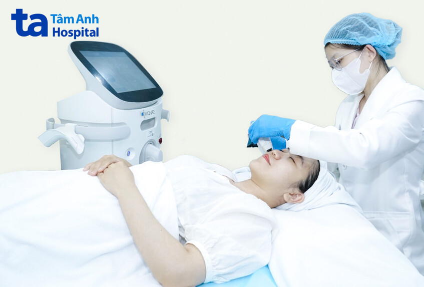 bác sĩ sử dụng sofwave làm đẹp cho khách hàng